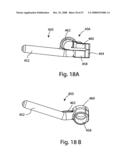 SYSTEM AND METHOD FOR FACET JOINT REPLACEMENT diagram and image