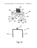 SYSTEM AND METHOD FOR FACET JOINT REPLACEMENT diagram and image