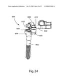 SYSTEM AND METHOD FOR FACET JOINT REPLACEMENT diagram and image