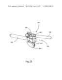 SYSTEM AND METHOD FOR FACET JOINT REPLACEMENT diagram and image