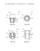 SYSTEM AND METHOD FOR FACET JOINT REPLACEMENT diagram and image