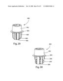 SYSTEM AND METHOD FOR FACET JOINT REPLACEMENT diagram and image