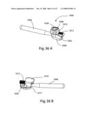 SYSTEM AND METHOD FOR FACET JOINT REPLACEMENT diagram and image