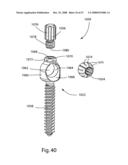 SYSTEM AND METHOD FOR FACET JOINT REPLACEMENT diagram and image