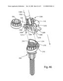 SYSTEM AND METHOD FOR FACET JOINT REPLACEMENT diagram and image