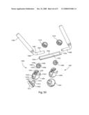 SYSTEM AND METHOD FOR FACET JOINT REPLACEMENT diagram and image