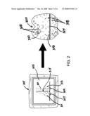 PATIENT-MATCHED SURGICAL COMPONENT AND METHODS OF USE diagram and image