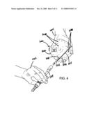 PATIENT-MATCHED SURGICAL COMPONENT AND METHODS OF USE diagram and image