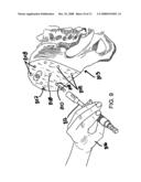 PATIENT-MATCHED SURGICAL COMPONENT AND METHODS OF USE diagram and image