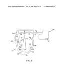 Endocardial Pacing Devices and Methods Useful for Resynchronization and Defibrillation diagram and image