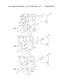 Endocardial Pacing Devices and Methods Useful for Resynchronization and Defibrillation diagram and image