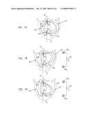 Endocardial Pacing Devices and Methods Useful for Resynchronization and Defibrillation diagram and image