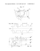 Endocardial Pacing Devices and Methods Useful for Resynchronization and Defibrillation diagram and image