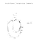 Endocardial Pacing Devices and Methods Useful for Resynchronization and Defibrillation diagram and image