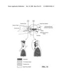 Endocardial Pacing Devices and Methods Useful for Resynchronization and Defibrillation diagram and image