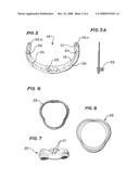 BIOPROSTHETIC HEART VALVE diagram and image