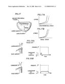 BIOPROSTHETIC HEART VALVE diagram and image