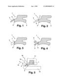 Removable Protective Lip on a Wiping Element diagram and image