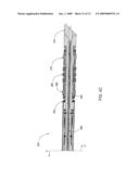 RETRIEVABLE BRIDGE PLUG diagram and image