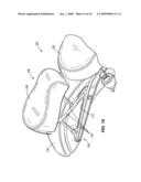 LUGGAGE RACK AND PASSENGER SEAT FOR A MOTORCYCLE diagram and image