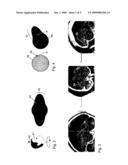 Method and Apparatus for Volume Rendering of Medical Data Sets diagram and image