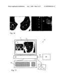 Method and Apparatus for Volume Rendering of Medical Data Sets diagram and image