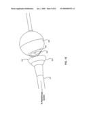 ORTHOVOLTAGE RADIOSURGERY diagram and image