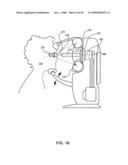 ORTHOVOLTAGE RADIOSURGERY diagram and image