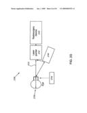 ORTHOVOLTAGE RADIOSURGERY diagram and image