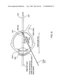 ORTHOVOLTAGE RADIOSURGERY diagram and image