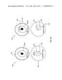 ORTHOVOLTAGE RADIOSURGERY diagram and image