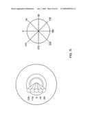 ORTHOVOLTAGE RADIOSURGERY diagram and image