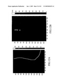 Method and apparatus for thickness compensation in mammographic images diagram and image