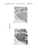 Cytotoxicity mediation of cells evidencing surface expression of CD44 diagram and image