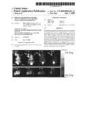 Molecular imaging of matrix metalloproteinase expression using labeled chlorotoxin diagram and image