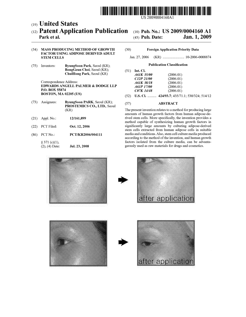 Mass Producing Method of Growth Factor Using Adipose Derived Adult Stem Cells - diagram, schematic, and image 01