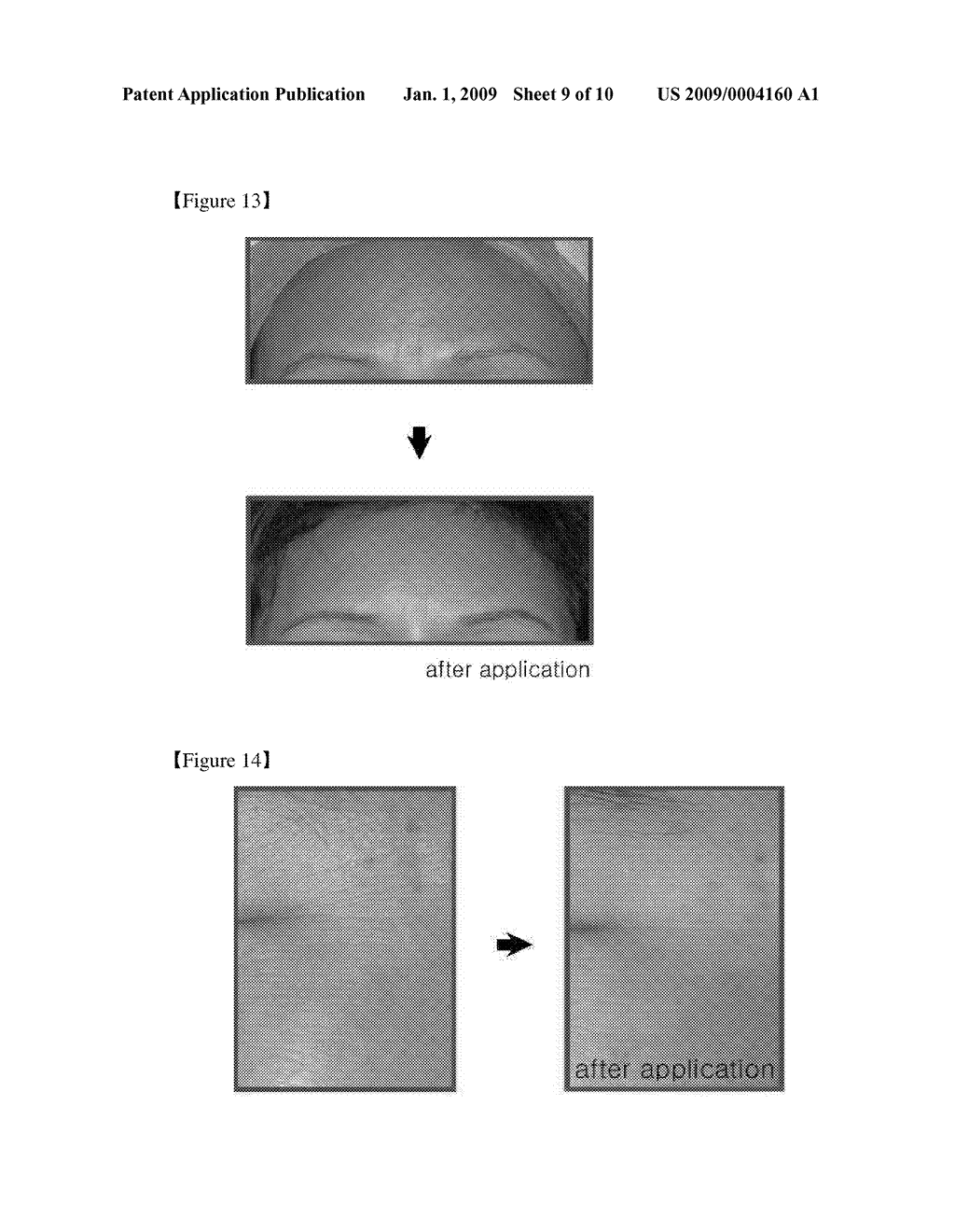 Mass Producing Method of Growth Factor Using Adipose Derived Adult Stem Cells - diagram, schematic, and image 10