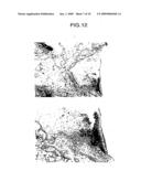 MEDICAMENT COMPRISING HGF GENE diagram and image