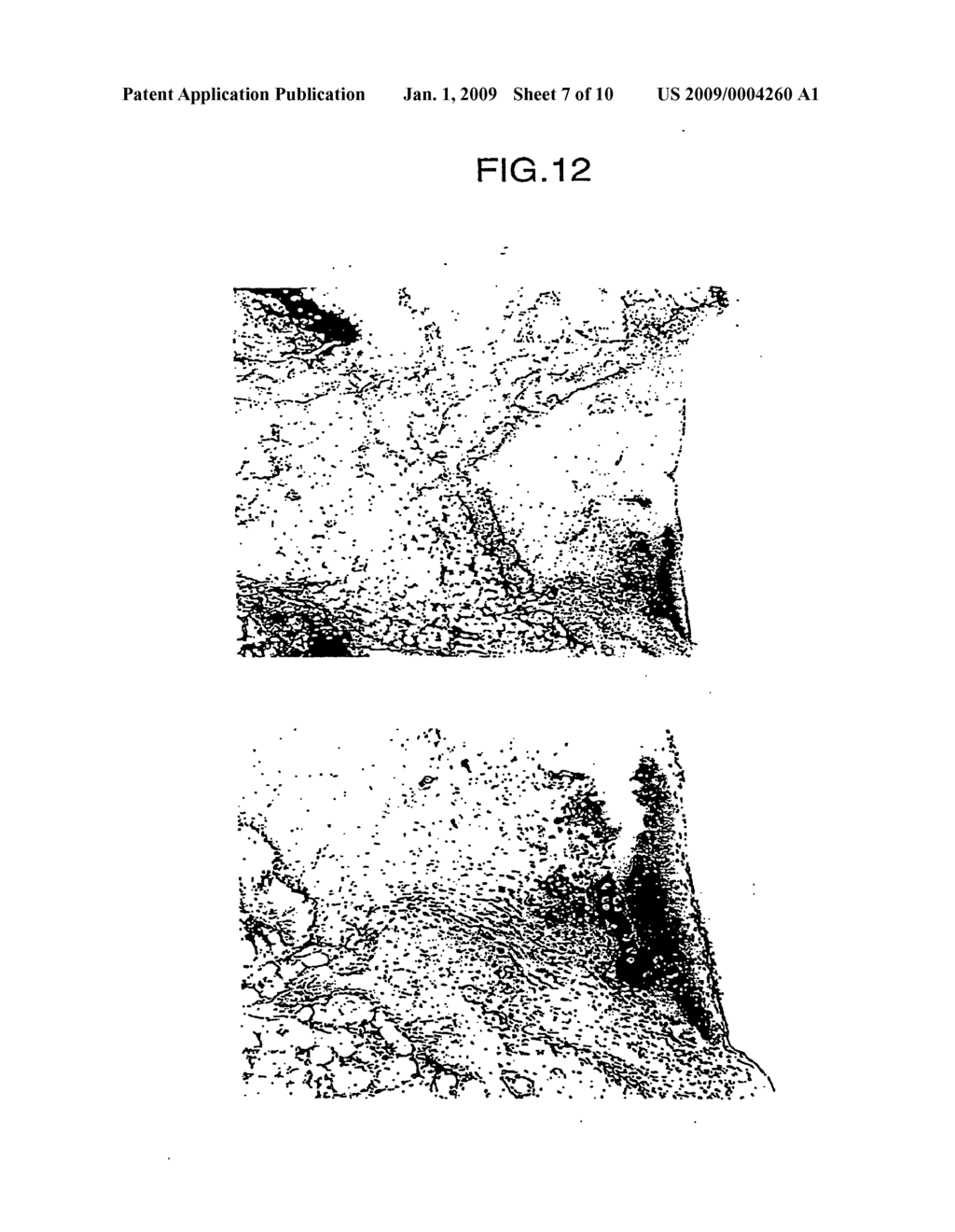 MEDICAMENT COMPRISING HGF GENE - diagram, schematic, and image 08