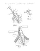 Endodontic Irrigation System diagram and image