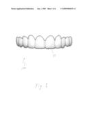 AESTHETIC DENTAL ARCH LAMINATES AND ADHESIVE diagram and image