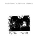 7B2 Knockout transgenic animals as models of endocrine disease diagram and image