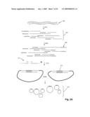 High throughput genome sequencing on DNA arrays diagram and image