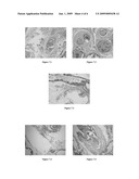 Use of Isothiocyanates Compounds in Treating Prostatic Diseases and Skin Cancer diagram and image