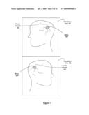 Non-invasive method for using 2D angiographic images for radiosurgical target definition diagram and image