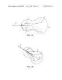 SHAPE-SENSING EXPANDABLE MEMBER diagram and image