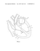 Ultrasound Image Processing To Render Three-Dimensional Images From Two-Dimensional Images diagram and image