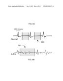 Ultrasound Image Processing To Render Three-Dimensional Images From Two-Dimensional Images diagram and image