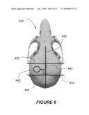 Systems and methods for opening of the blood-brain barrier of a subject using ultrasound diagram and image