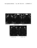 Systems and methods for opening of the blood-brain barrier of a subject using ultrasound diagram and image